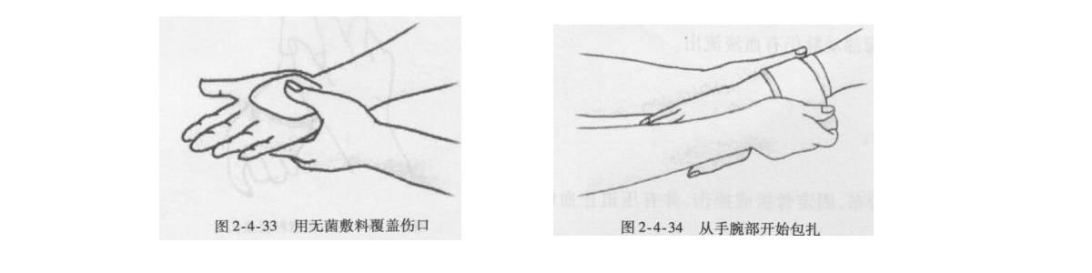 醫(yī)用繃帶8字包扎法.jpg