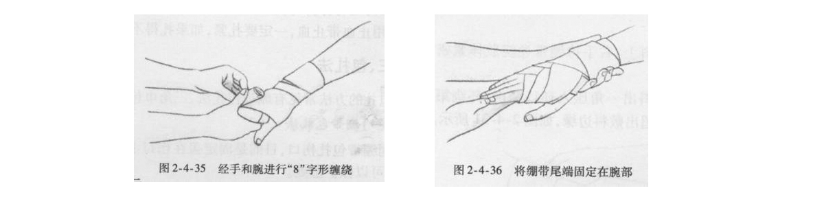 醫(yī)用繃帶8字包扎法-2.jpg